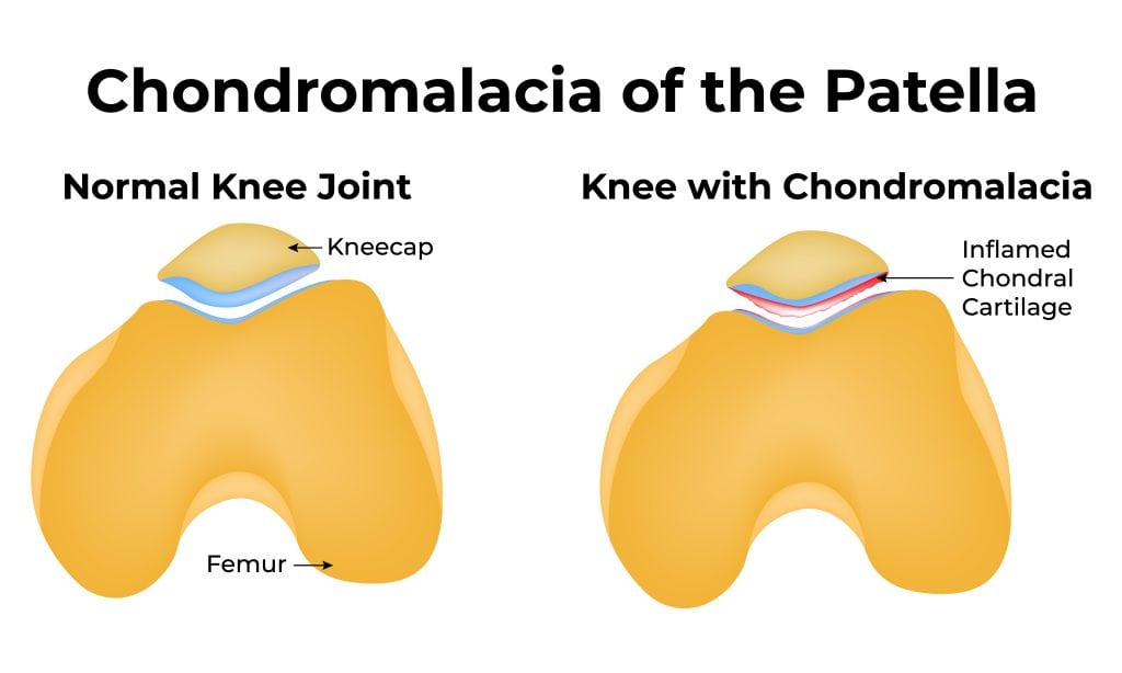 228292584 58dd2e56 29ae 45f3 aac3 a62597b3a8d9