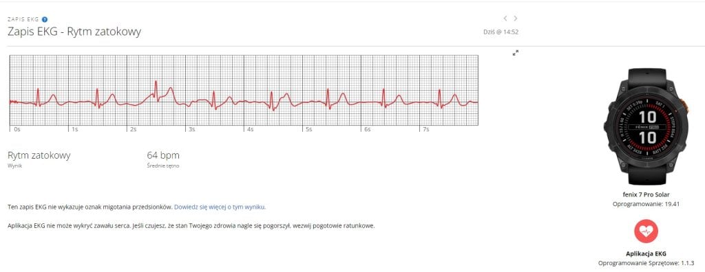 Garmin udostępnił rejestrowanie EKG w Fenixie 7 Pro i Epix'ie 2 Pro 2 ekg
