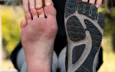 Ból piszczeli i kolan po bieganiu – co mówi o Twojej technice 3 bolpiszczeliikolanpobieganiu comowiotwojejtechnice